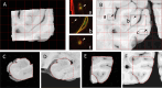 Fig 10