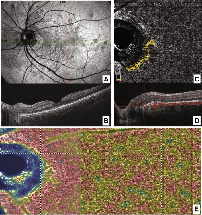 Fig. 2