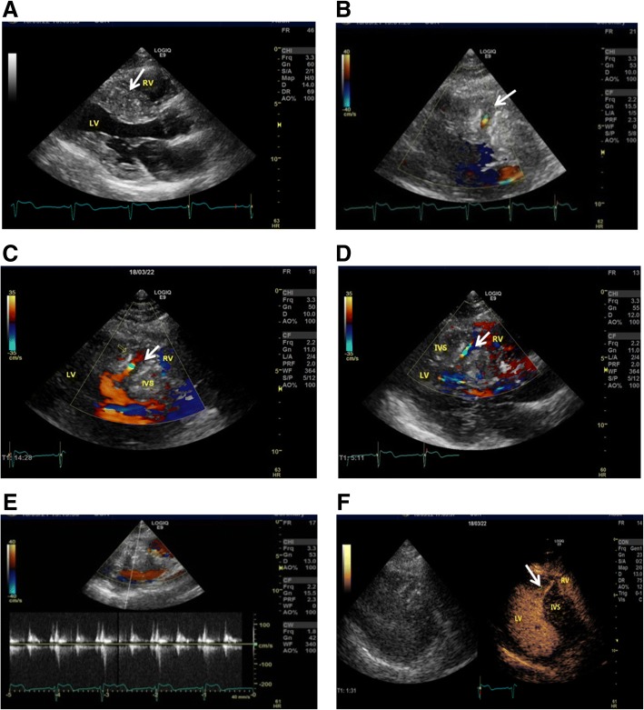 Fig. 2