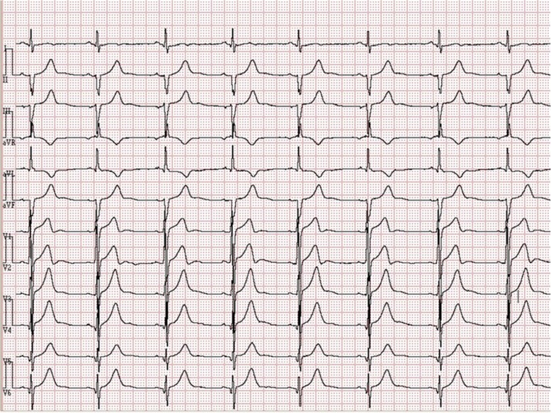 Fig. 1