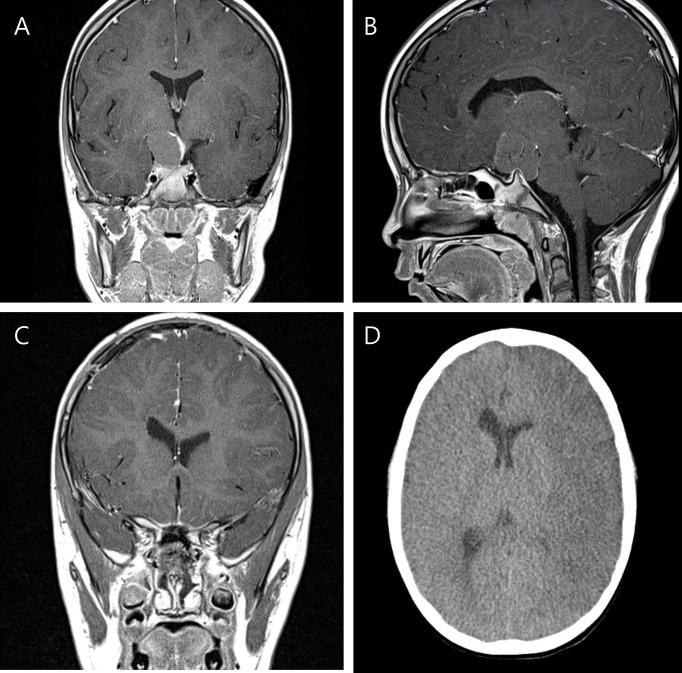 Figure 2