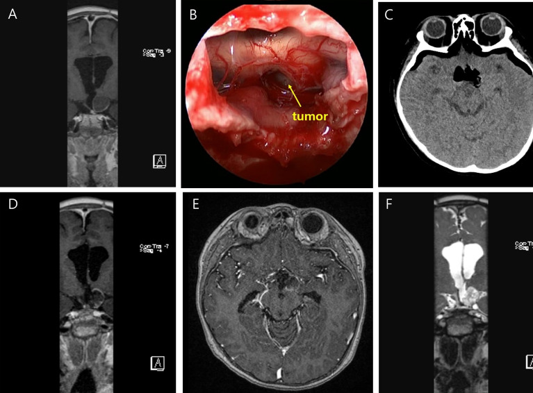 Figure 3