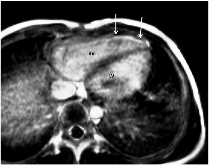 Fig. 2