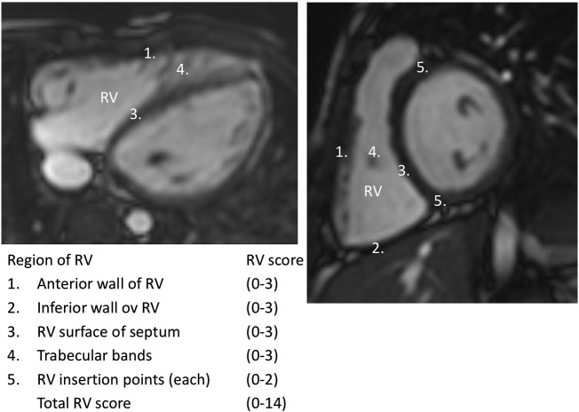 Fig. 1