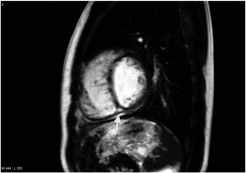 Fig. 3