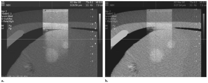 Figure 16