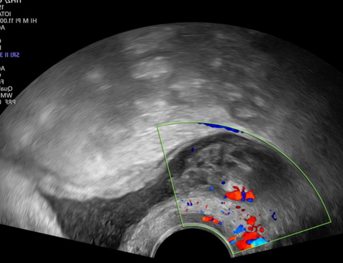 graphic file with name 117_2023_1215_Fig1_HTML.jpg