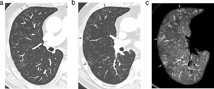 Fig 7: