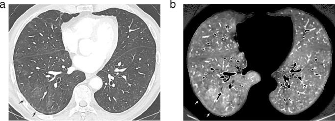 Fig 5: