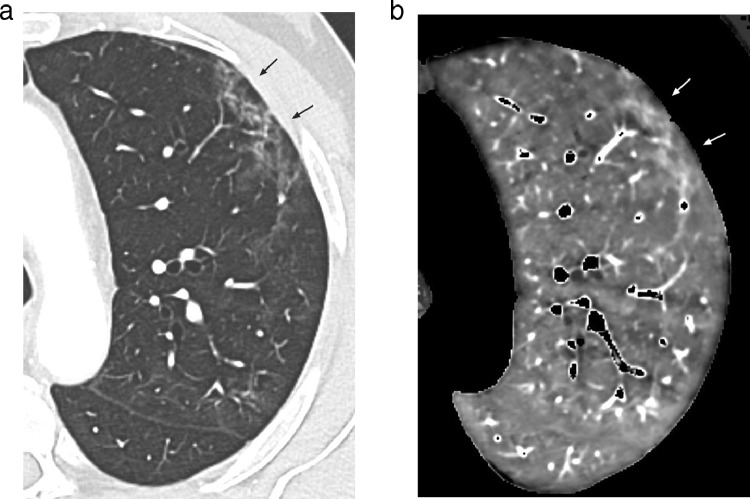 Fig 6: