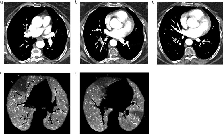 Fig 2: