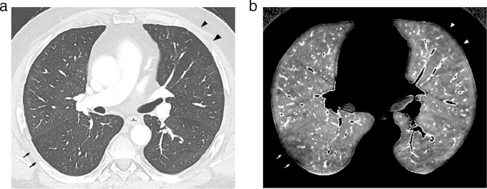 Fig 4: