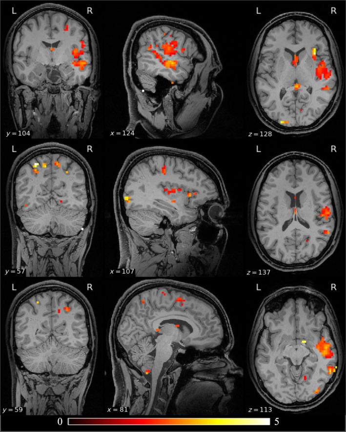 FIGURE 2