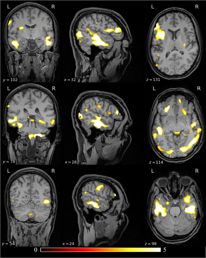 FIGURE 1