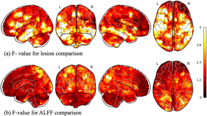 FIGURE 3