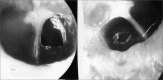 Figure 2c