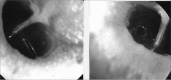 Figure 2ª