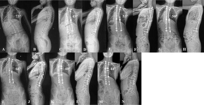 Fig. 2 A-N