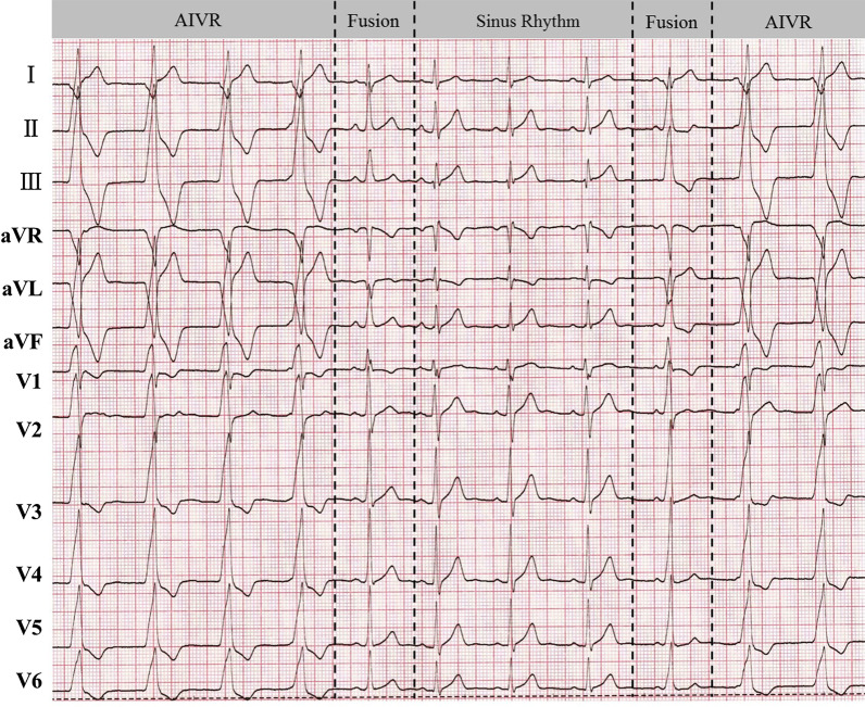 Fig. 2