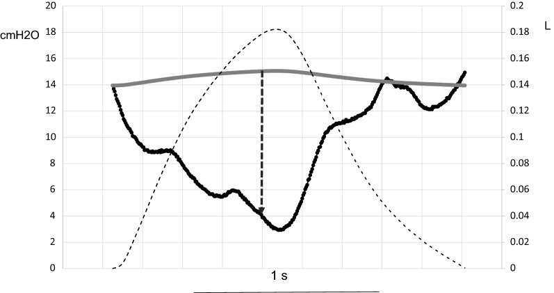 Fig. 1