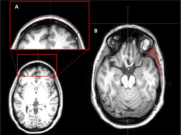 Fig 2.