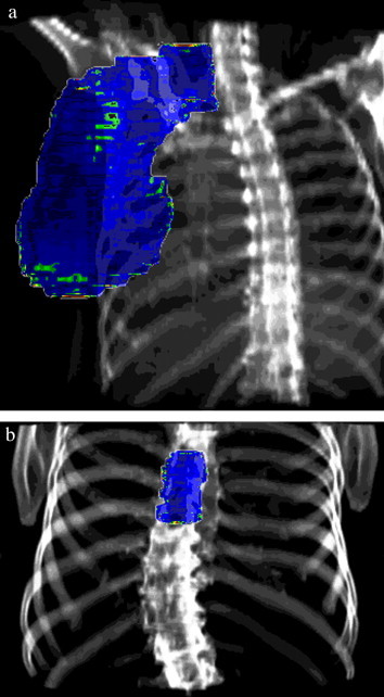 Fig. 11