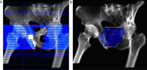 Fig. 13