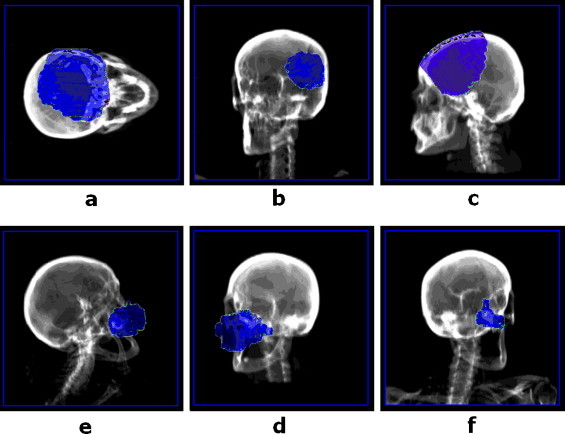 Fig. 8