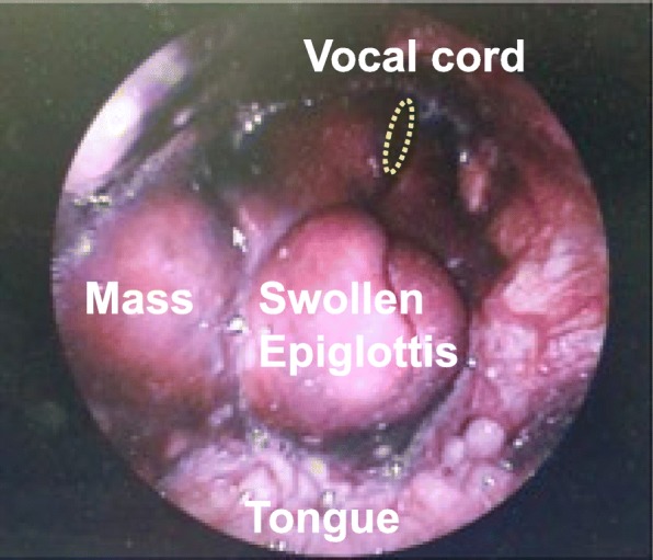 Fig. 2