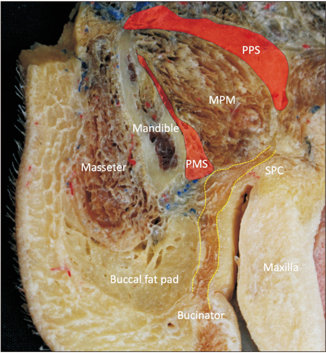 Fig. 3