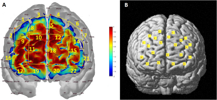 FIGURE 1