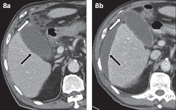 Fig. 8