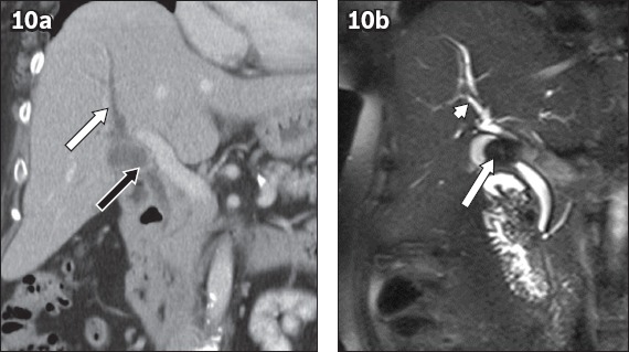 Fig. 10