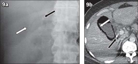 Fig. 9