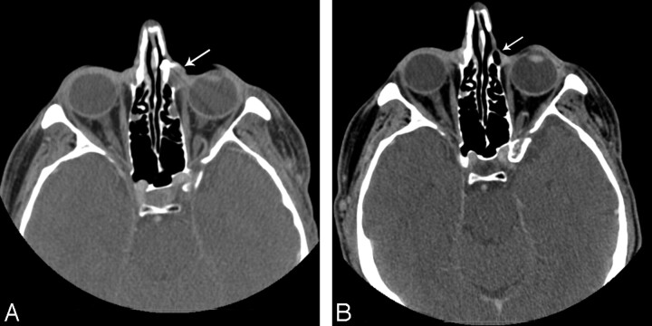 Fig 2.