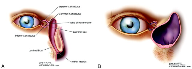 Fig 3.