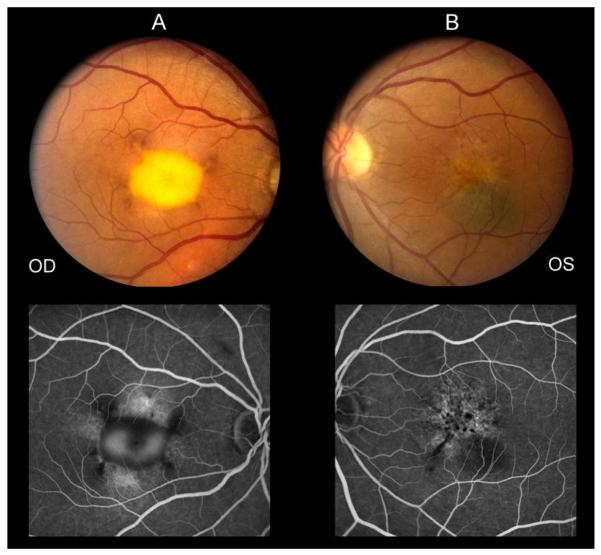 Fig. 1