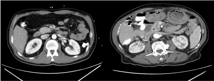 Fig. 2