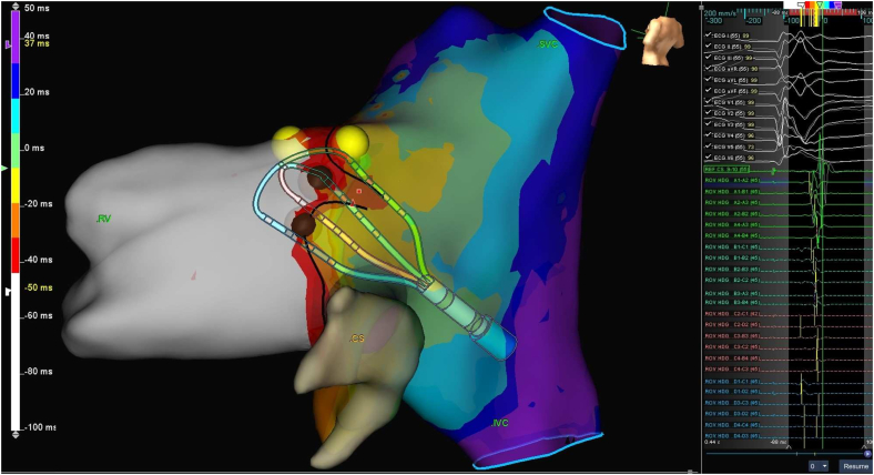 Figure 3