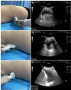 Fig. 1