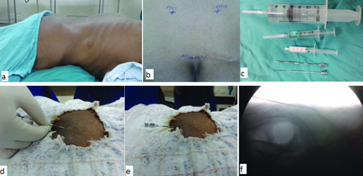 [Table/Fig-4]: