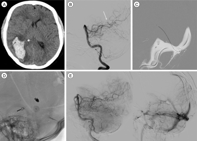 Fig. 1