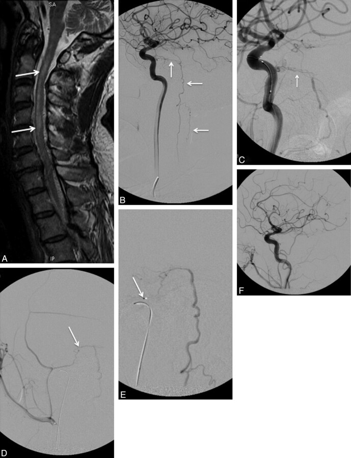 Fig 6.