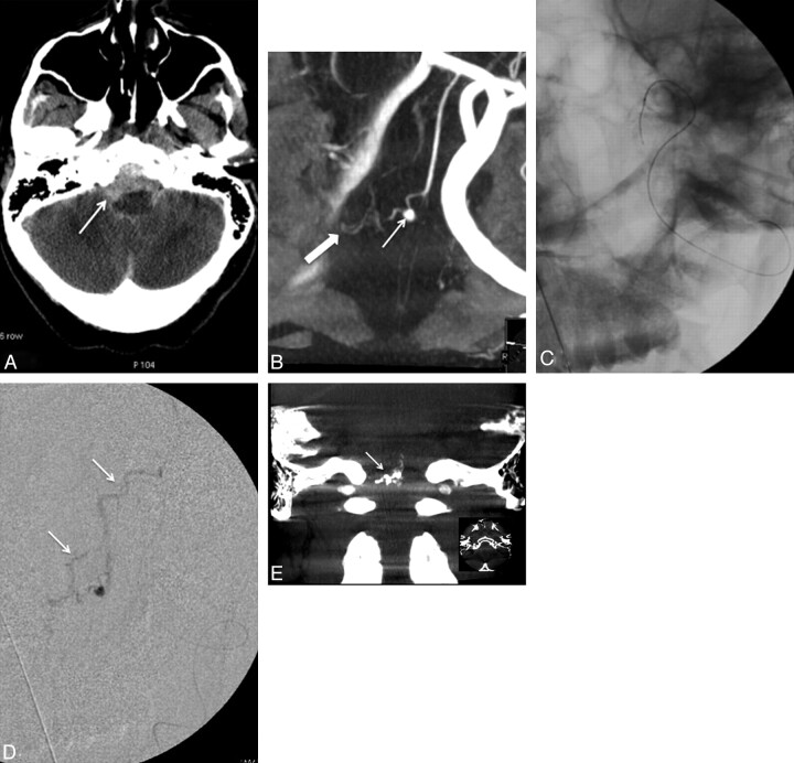 Fig 2.