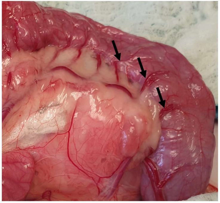 Figure 18