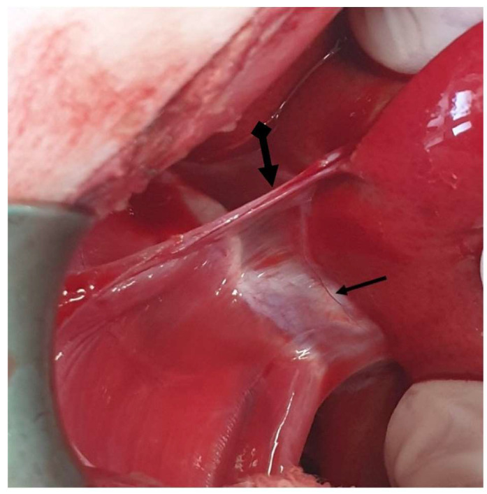 Figure 21