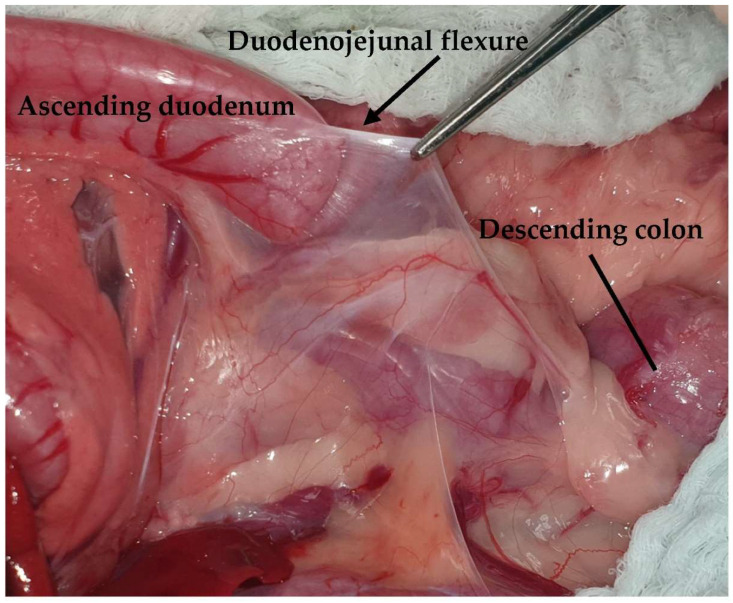 Figure 11