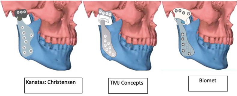 Fig. 3