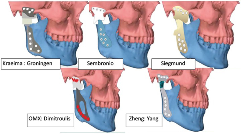 Fig. 4