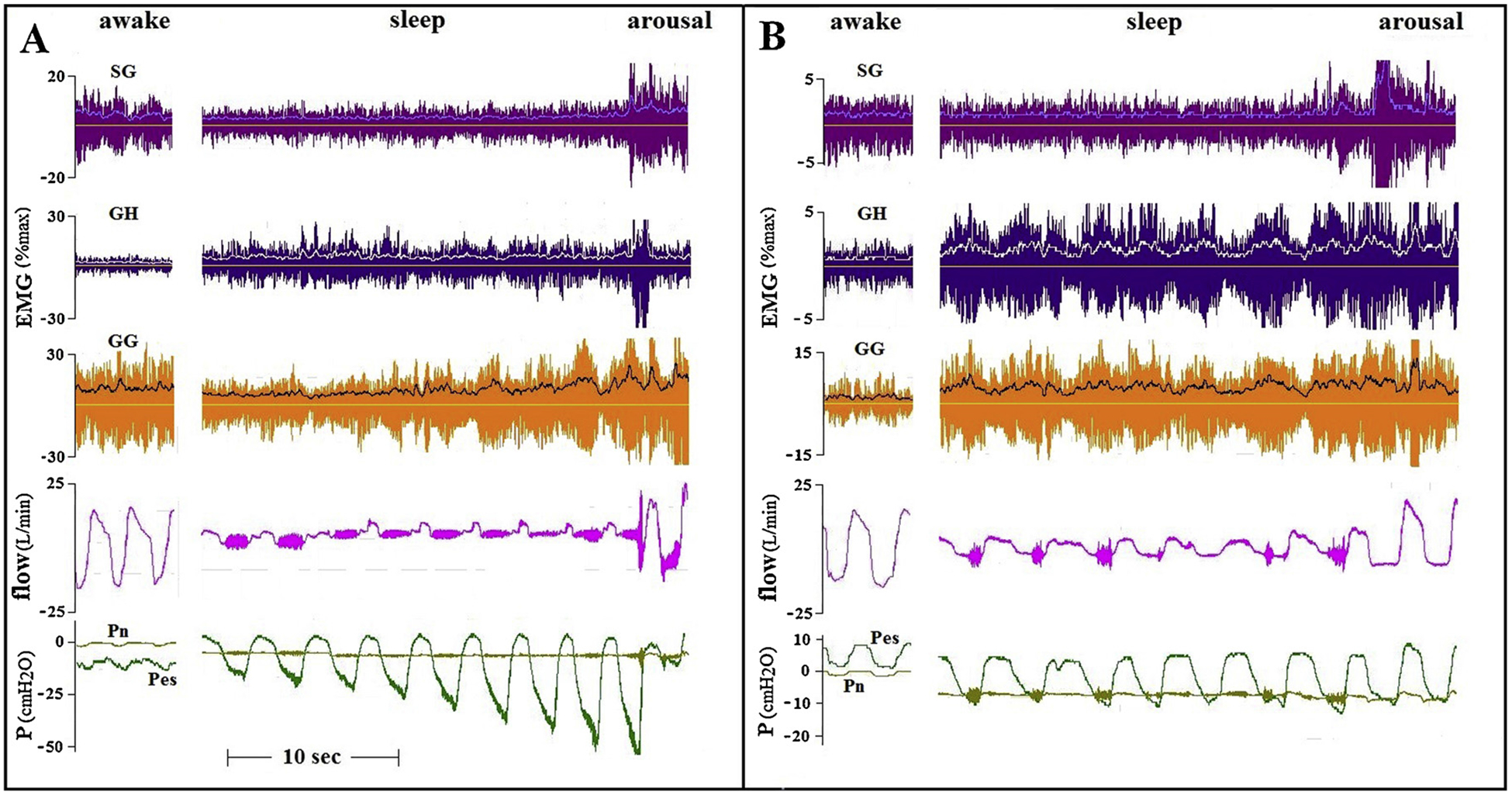 Fig. 10.